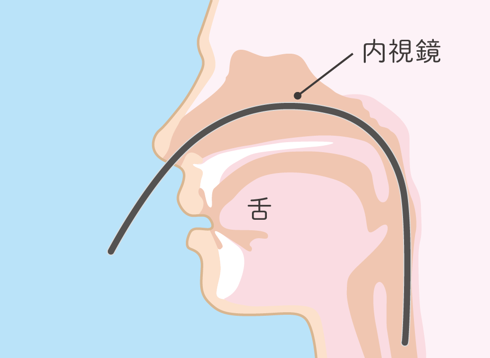 経鼻内視鏡検査