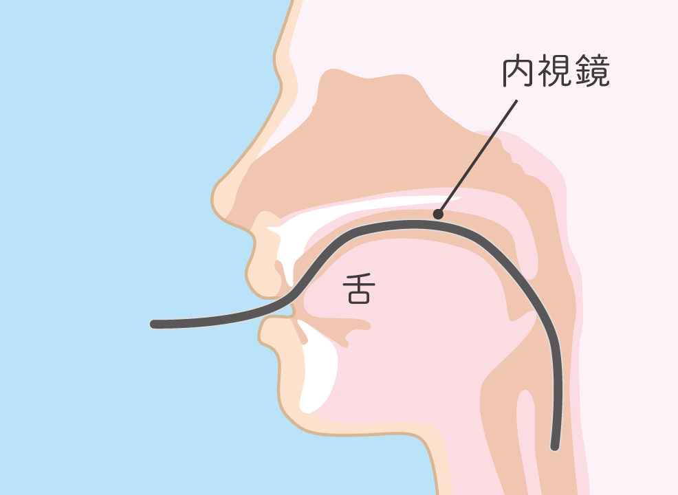 経口内視鏡検査